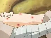 Tenketsu01
