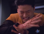 Harry Kim hat starke Schmerzen