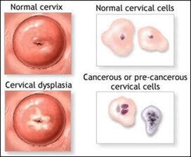 C C Utero6