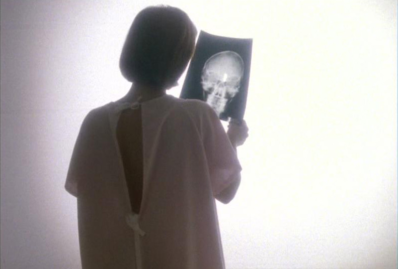 Scully_tumor_x-ray_light_Memento_Mori.jpg