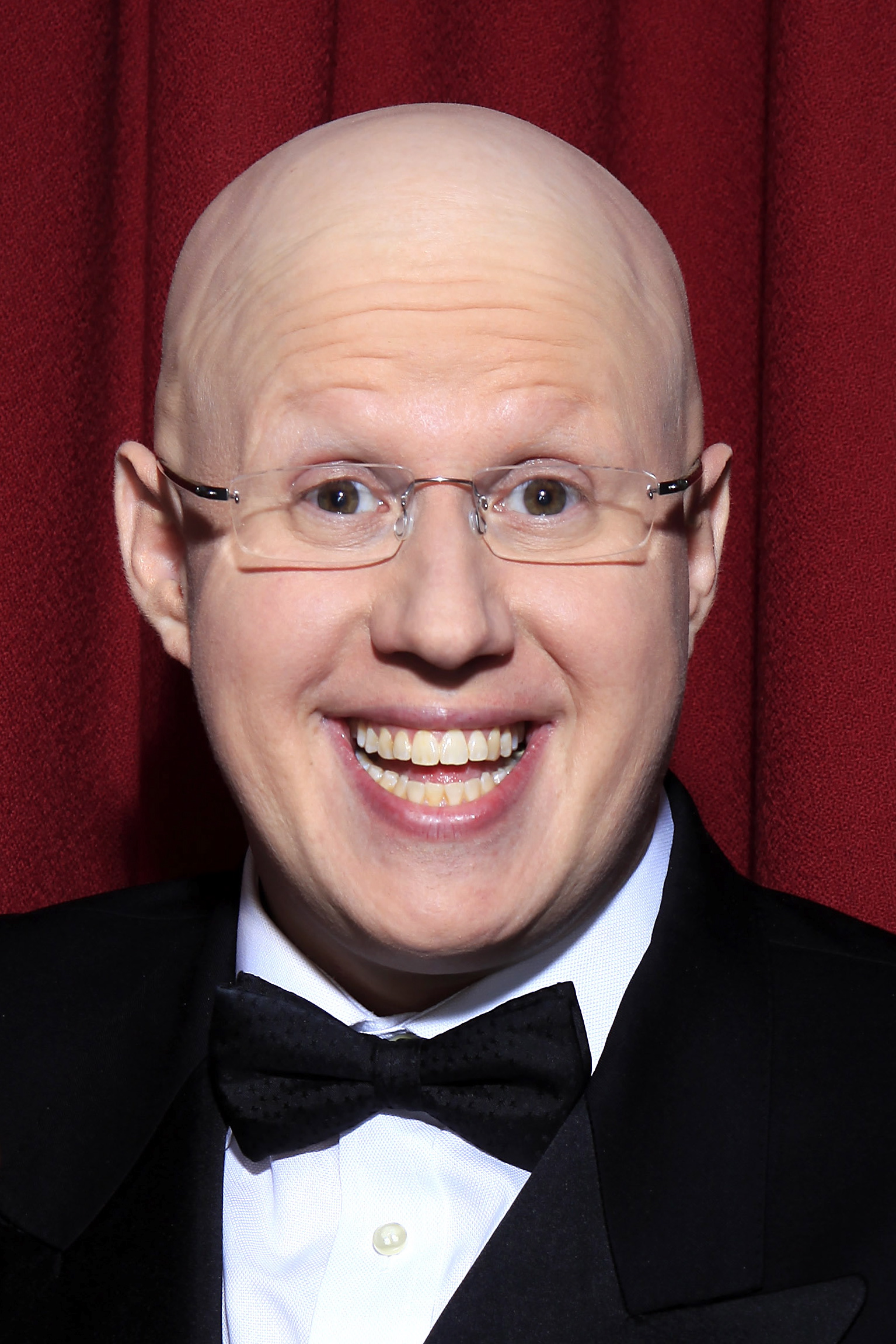 Matt Lucas belly